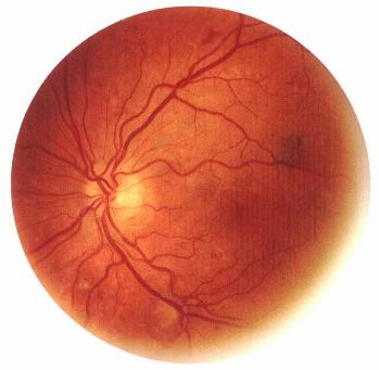 blood_vessels_in_retina